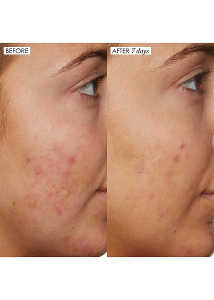 B3 Nice 10% Niacinamide Serum 30ml