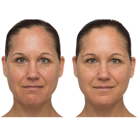 Drunk Elephant T.L.C. Sukari Babyfacial™